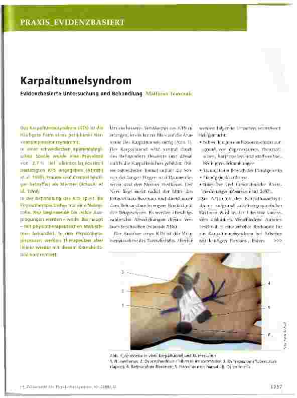 Vorschauseite 1: KarpaltunnelsyndromEvidenzbasierte Untersuchung und Behandlung