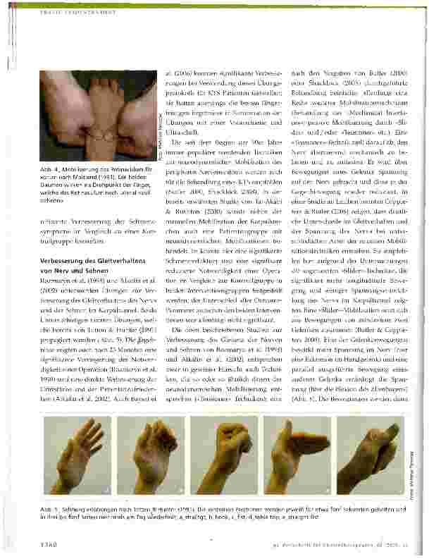 Vorschauseite 4: KarpaltunnelsyndromEvidenzbasierte Untersuchung und Behandlung