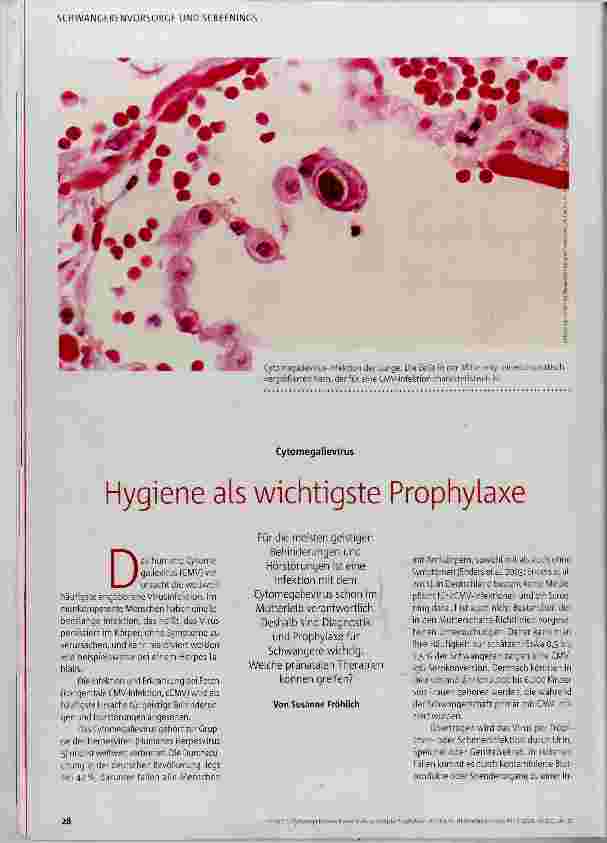 Vorschauseite 1: Hygiene als wichtigste Prophylaxe