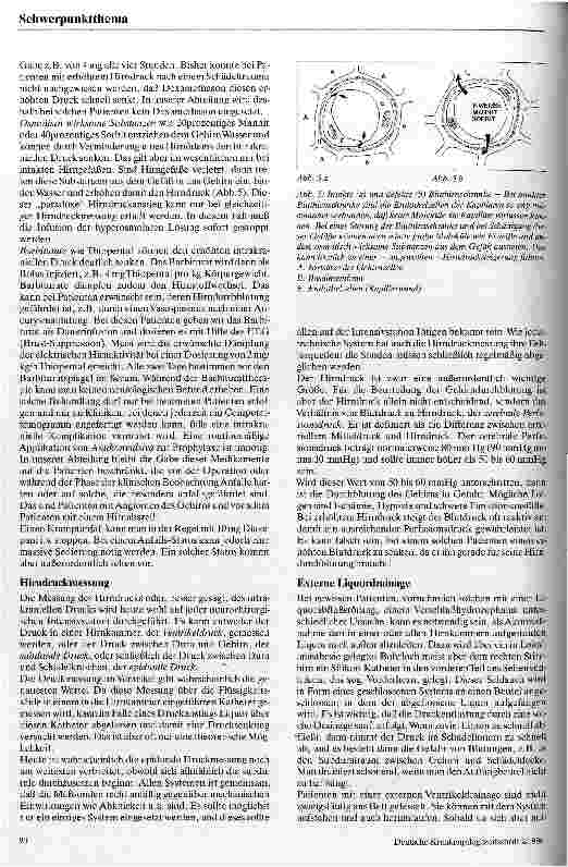 Vorschauseite 4: Krankenpflege auf der neurochirurgischen Intensivstation
