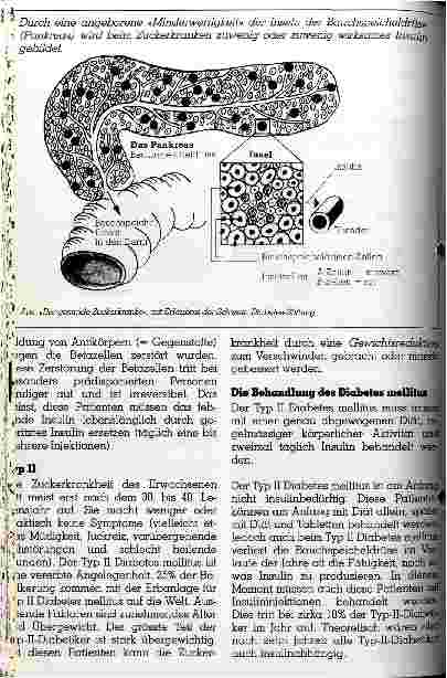 Vorschauseite 2: Die Zuckerkrankheit