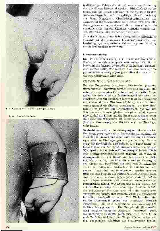 Vorschauseite 2: Behandlung des gliedmaßengeschädigten Kindes