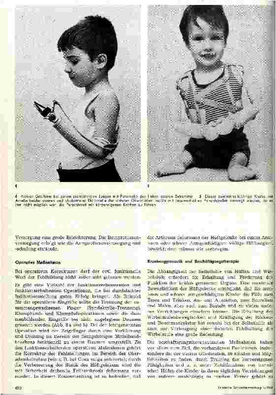 Vorschauseite 4: Behandlung des gliedmaßengeschädigten Kindes