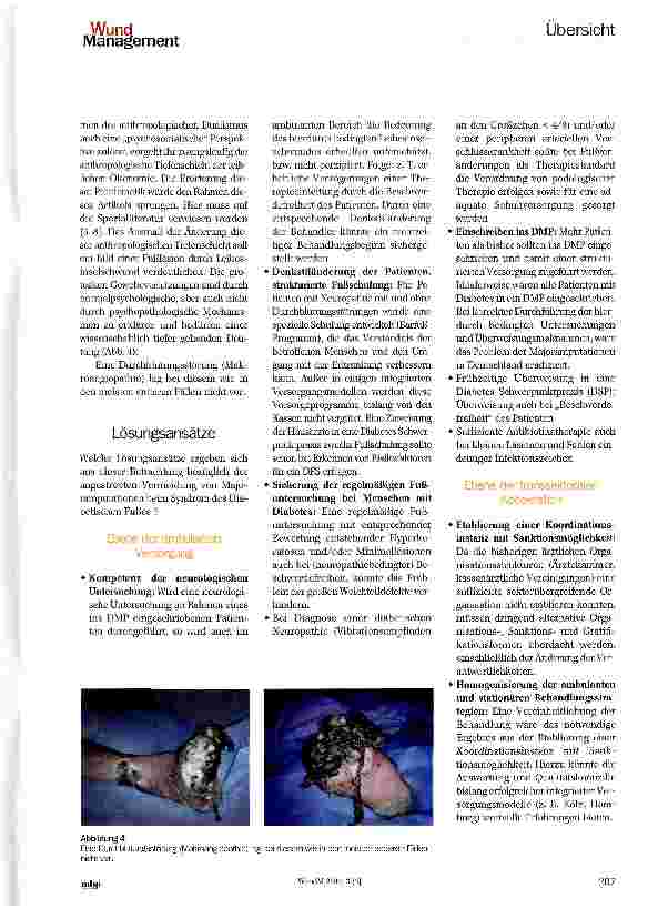 Vorschauseite 4: Vermeidungsstrategie Majoramputation — Extremitätengefährdung durch Diabetisches Fußsyndrom (DFS)