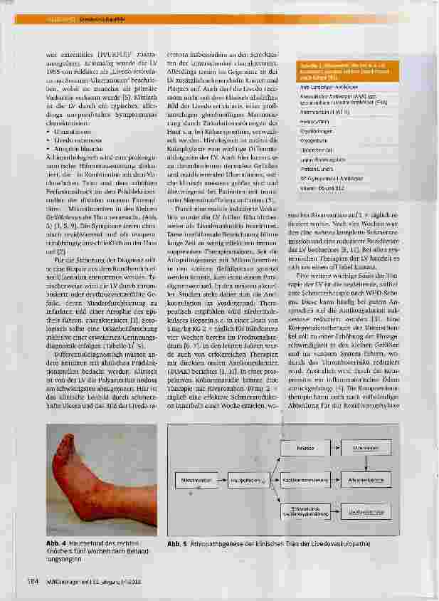 Vorschauseite 3: Erstdiagnose einer Livedovaskulopathie nach 40 Jahren und erfolgreiche Therapie mit niedermolekularem Heparin