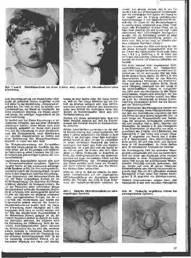 Vorschauseite 4: Kinderheilkunde 14. Folge: Angeborene Stoffwechselstörungen