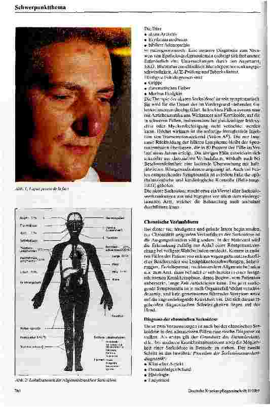 Vorschauseite 3: Sarkoidose