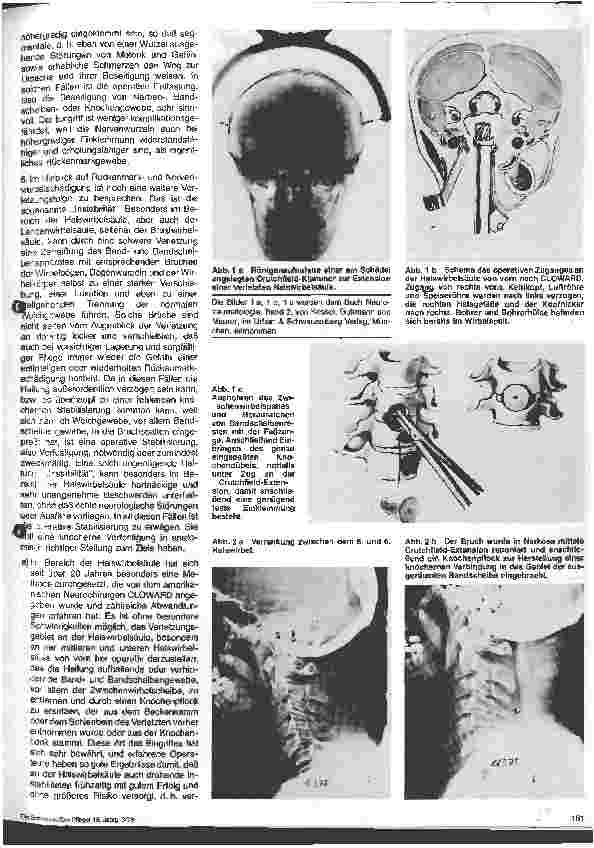 Vorschauseite 2: Die Rehabilitation traumatisch Querschnittgelähmter 4. Folge: Über die operative Behandlung v. Wirbelsäulenverletzungen