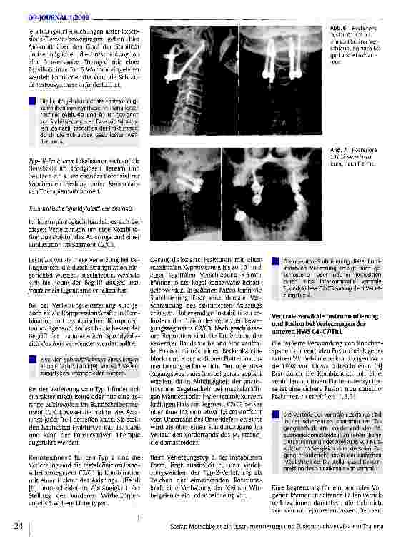 Vorschauseite 5: Instrumentierung und Fusion nach zervikalem Trauma