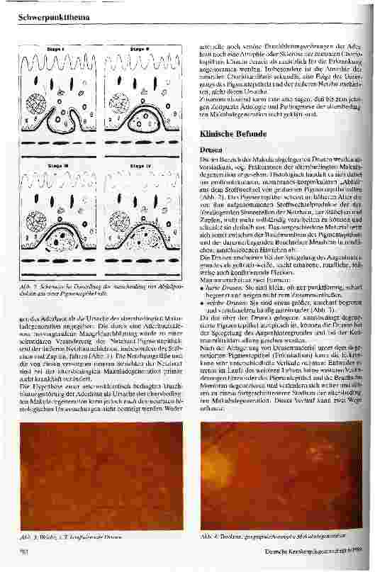 Vorschauseite 2: Die altersbedingte Makuladegeneration Ätiologie, Pathophysiologie, Klinik, Therapie