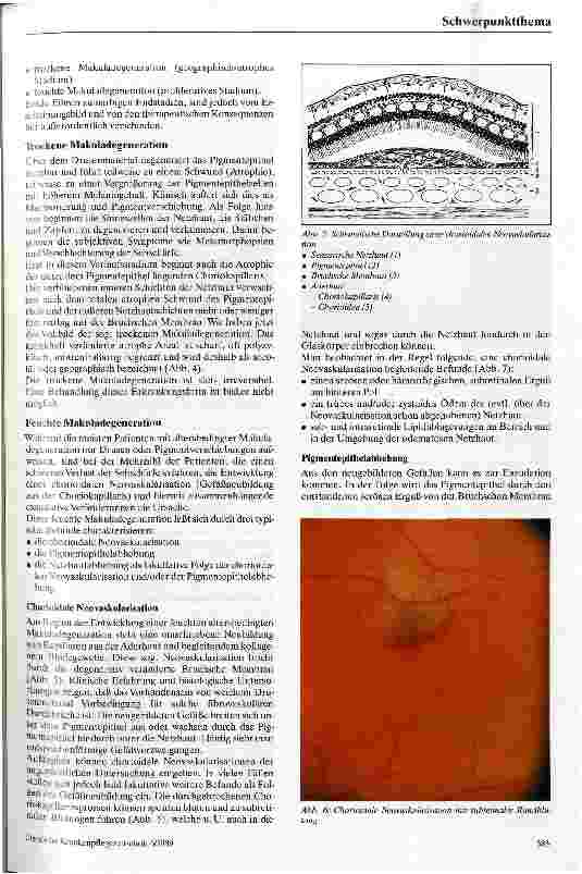 Vorschauseite 3: Die altersbedingte Makuladegeneration Ätiologie, Pathophysiologie, Klinik, Therapie