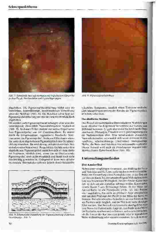 Vorschauseite 4: Die altersbedingte Makuladegeneration Ätiologie, Pathophysiologie, Klinik, Therapie