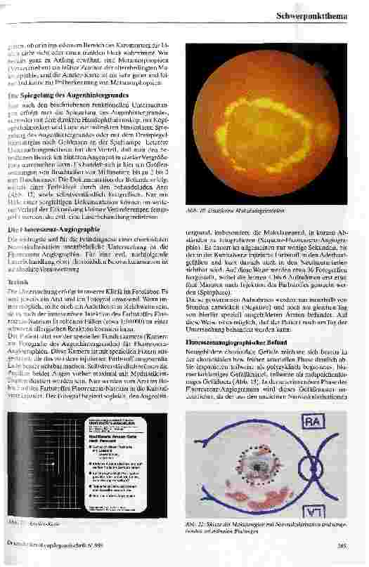 Vorschauseite 5: Die altersbedingte Makuladegeneration Ätiologie, Pathophysiologie, Klinik, Therapie