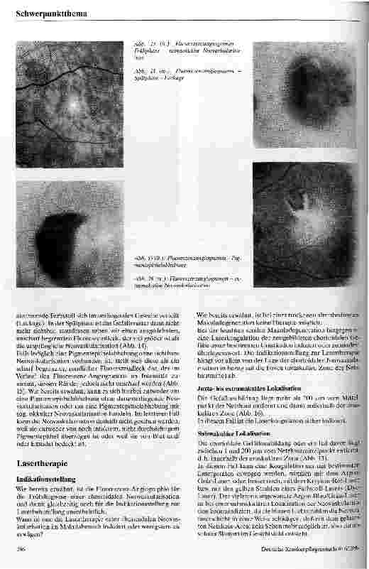 Vorschauseite 6: Die altersbedingte Makuladegeneration Ätiologie, Pathophysiologie, Klinik, Therapie