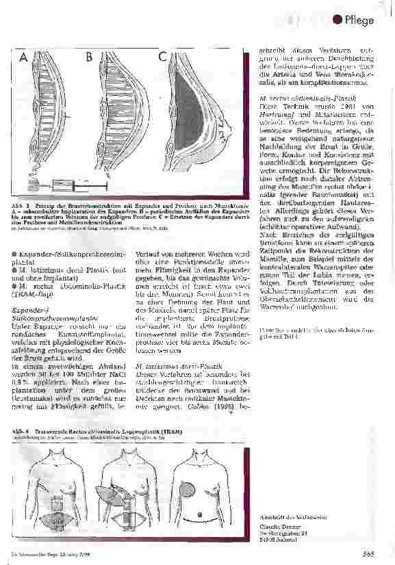 Vorschauseite 4: Das Mammakarzinom
