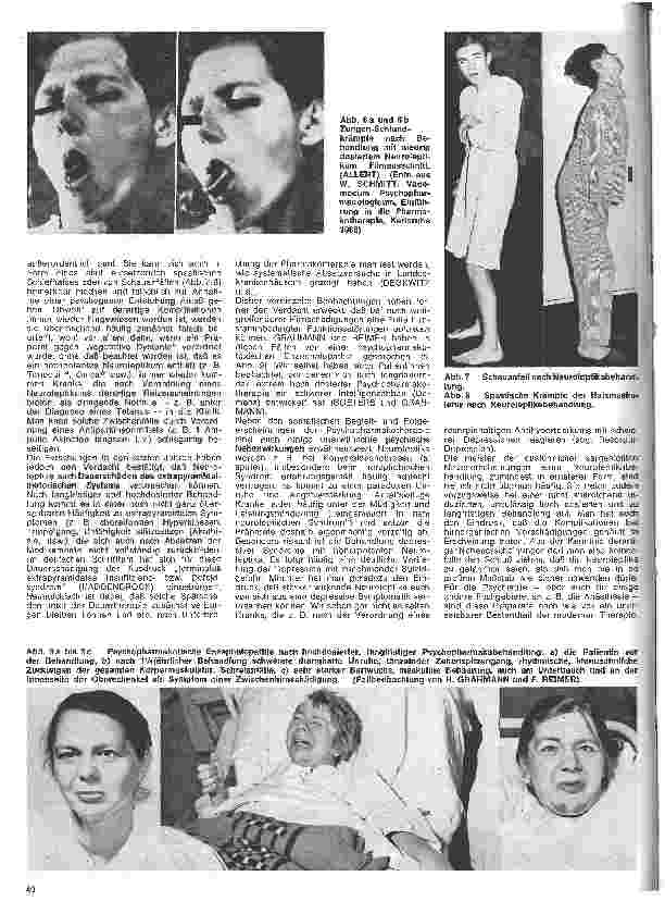 Vorschauseite 4: Die Schwester in der Psychiatrie 11. Folge: Therapie endogener Psychosen 2. Die Psychopharmakotherapie (1. Teil)