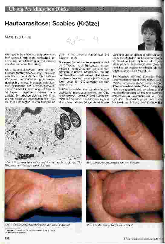 Vorschauseite 1: Hautparasitose: Scabies (Krätze)
