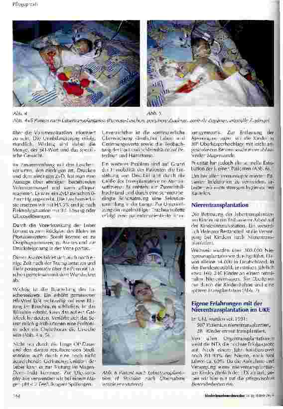 Vorschauseite 2: Organtransplantation Pflegerische Aspekte