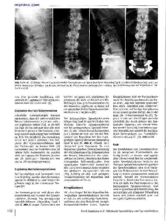 Vorschauseite 5: Isthmische Spondylolyse und Spondylolisthese