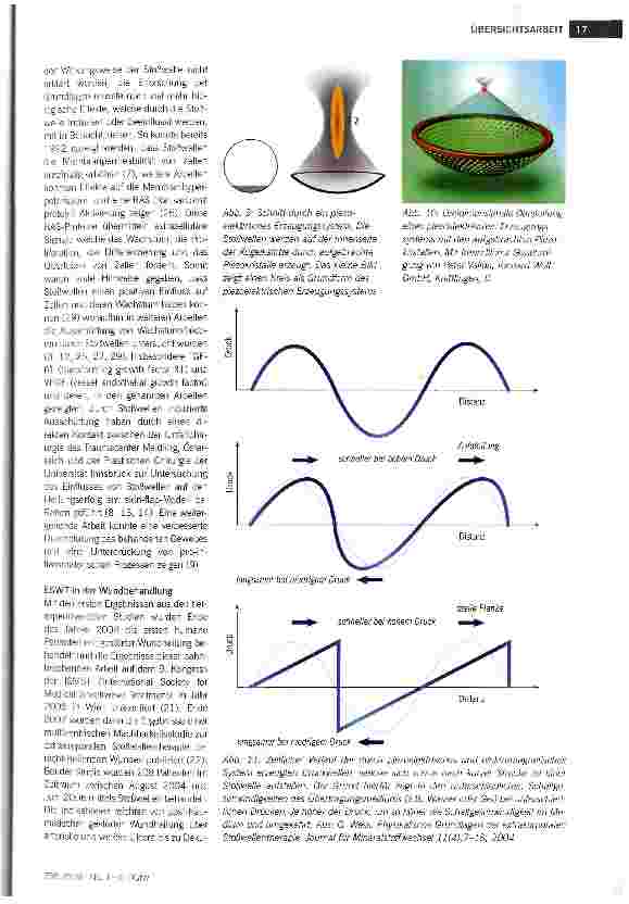 Vorschauseite 4: Die extrakorporale Stoßwellentherapie als neue Methode zur Stimulation der Heilung komplexer Wunden: eine Übersicht