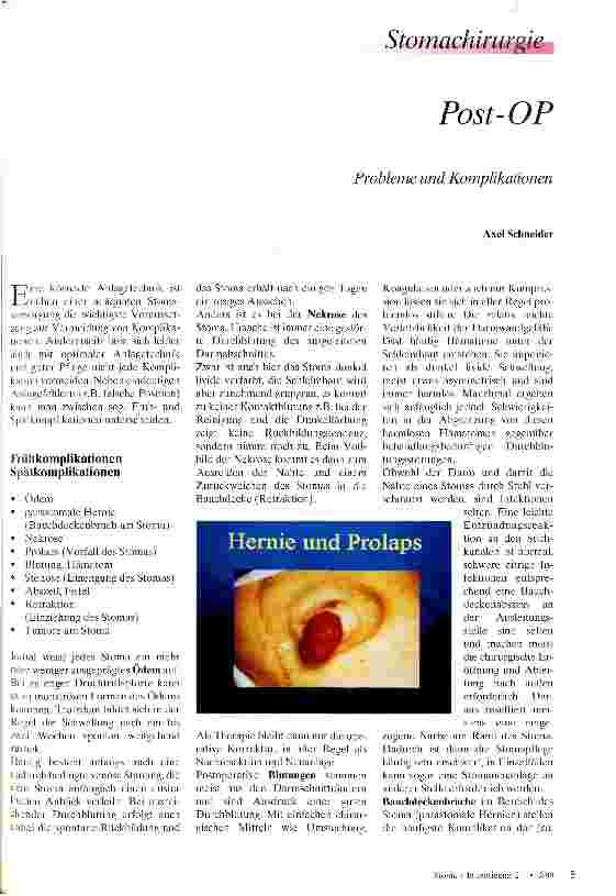 Vorschauseite 1: Post-OP Stomachirurgie: Probleme und Komplikationen
