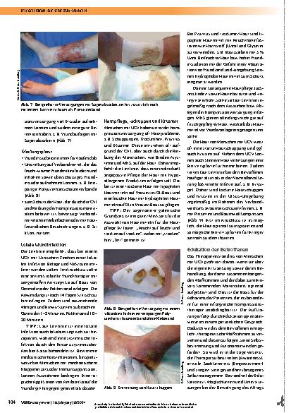 Vorschauseite 3: Praxisaspekte der AWMF S2k-Leitlinie „Diagnostik und Therapie des Ulcus cruris venosum“, Teil 2
