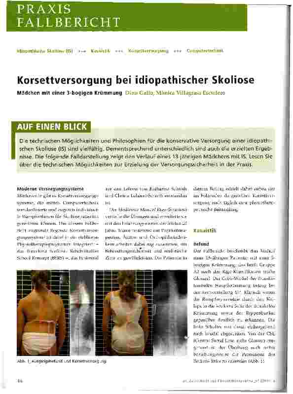 Vorschauseite 1: Korsettversorgung bei idiopathischer Skoliose