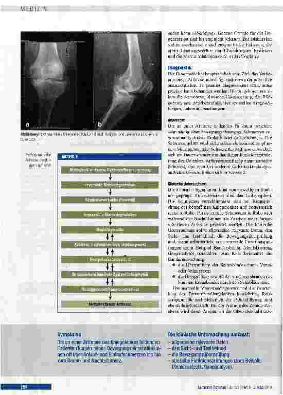 Vorschauseite 3: Epidemiologie, Ätiologie, Diagnostik und Therapie der Gonarthrose