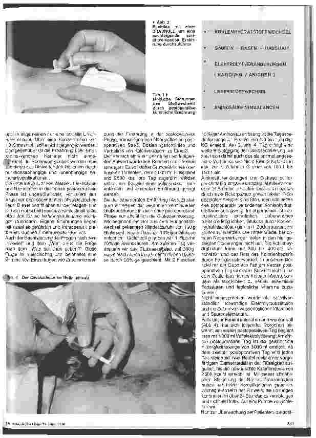 Vorschauseite 2: Praxis der postoperativen Ernährung.