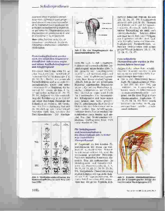 Vorschauseite 2: Posttraumatische Schulterprothesen: Indikation, Technik, Ergebnisse und Rehabilitation
