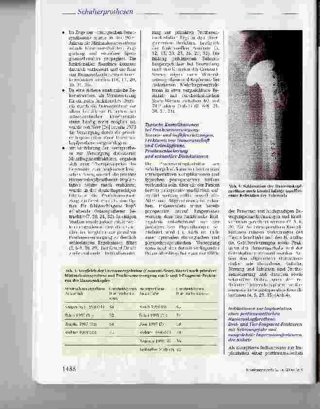 Vorschauseite 3: Posttraumatische Schulterprothesen: Indikation, Technik, Ergebnisse und Rehabilitation