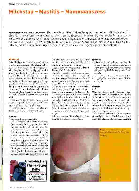Vorschauseite 1: Milchstau - Mastitis - Mammaabszess