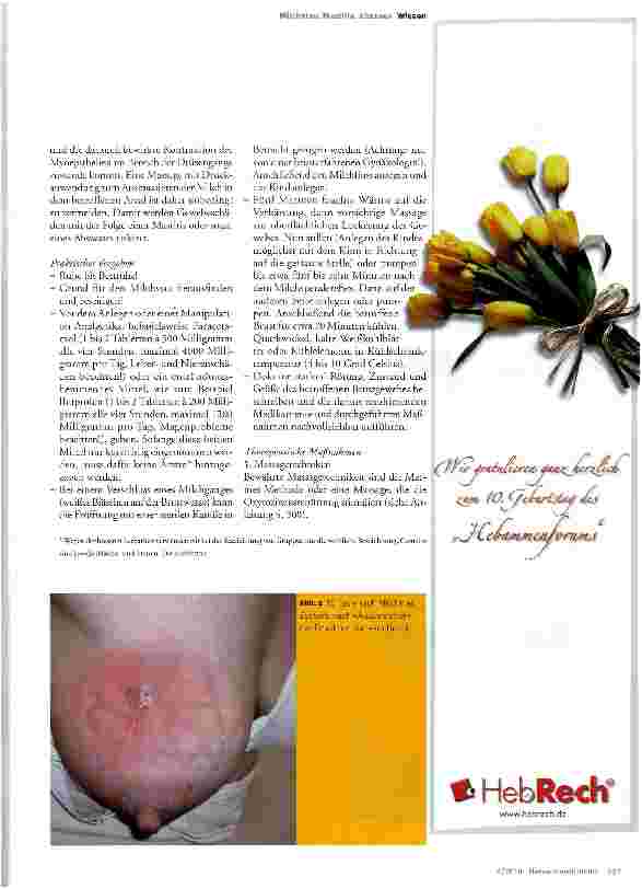 Vorschauseite 2: Milchstau - Mastitis - Mammaabszess