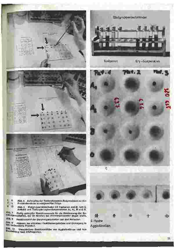 Vorschauseite 2: Transfusionskunde, Blutgruppenserologie und Immunhämatologie 8. Folge:III. Serologisch bedingte Transfusionsstörungen (2)