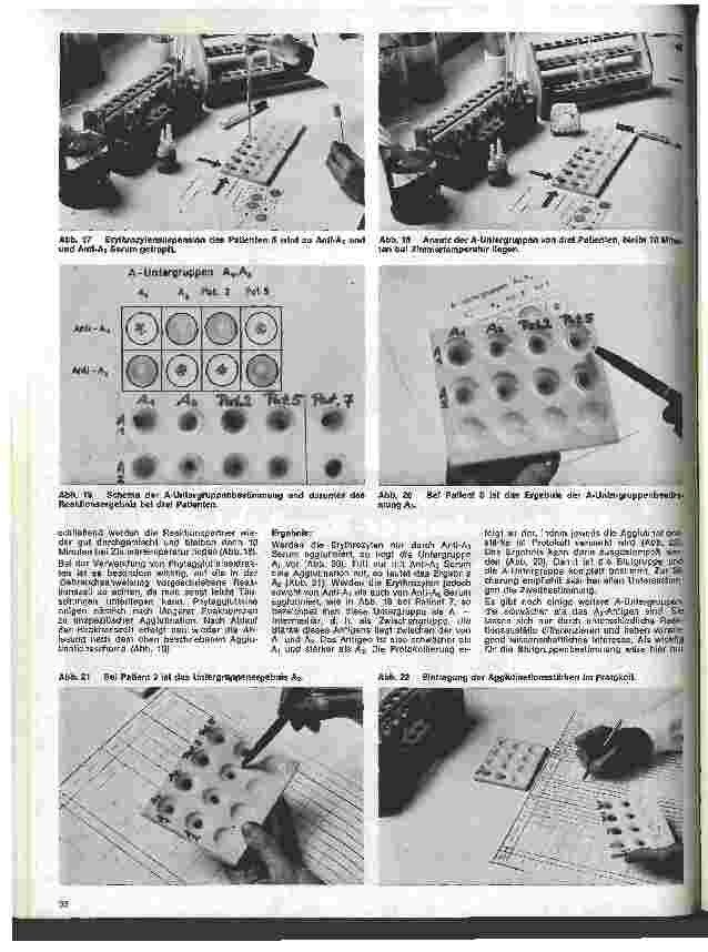 Vorschauseite 4: Transfusionskunde, Blutgruppenserologie und Immunhämatologie 8. Folge:III. Serologisch bedingte Transfusionsstörungen (2)