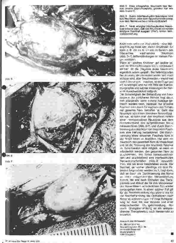 Vorschauseite 4: Chirurgie der peripheren Nerven