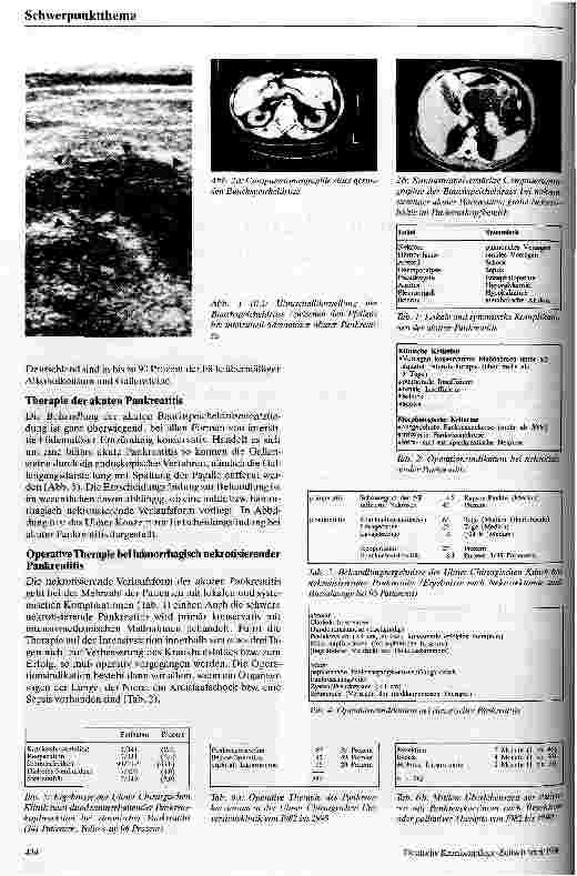 Vorschauseite 2: Möglichkeiten und Grenzen der operativen Therapie bei Pankreaserkrankungen