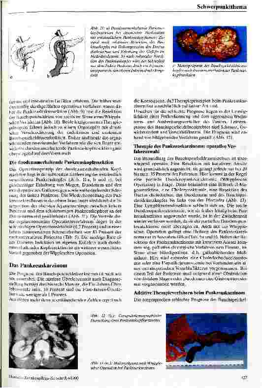 Vorschauseite 5: Möglichkeiten und Grenzen der operativen Therapie bei Pankreaserkrankungen
