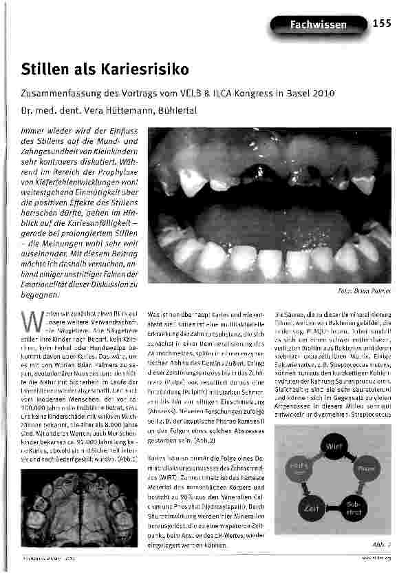 Vorschauseite 1: Stillen als Kariesrisiko