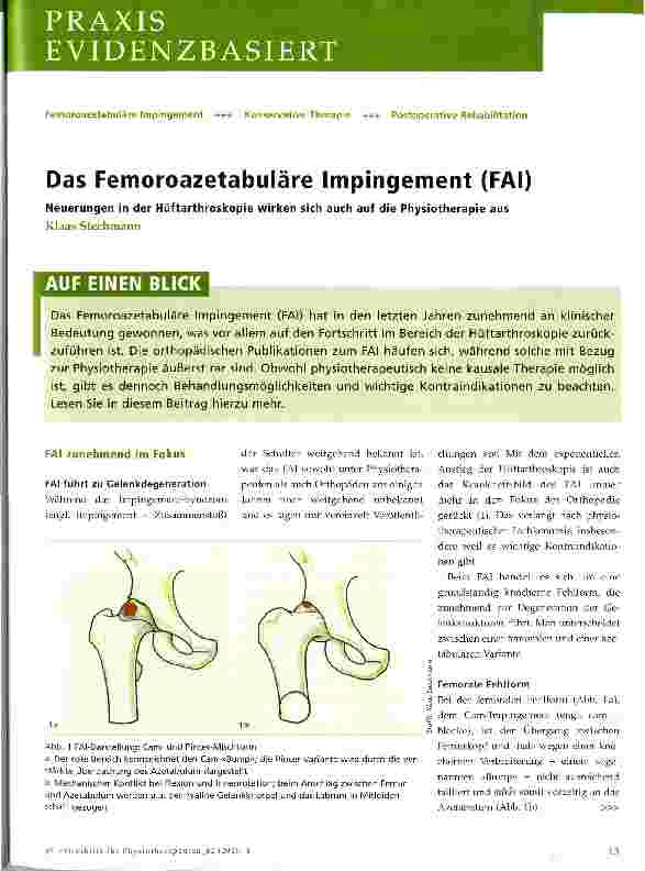 Vorschauseite 1: Das Femoroazetabuläre Impingement (FAI)