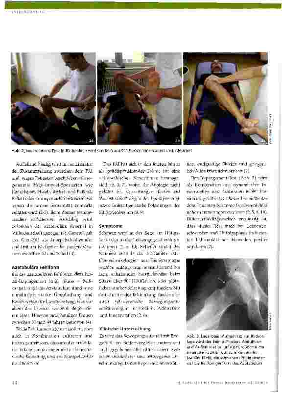 Vorschauseite 2: Das Femoroazetabuläre Impingement (FAI)