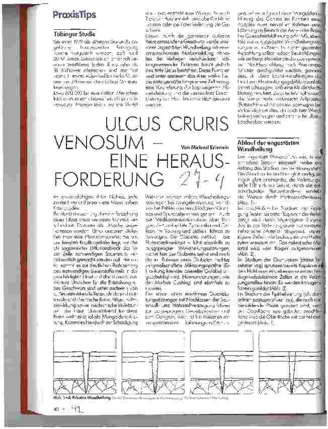 Vorschauseite 1: Ulcus cruris venosum - eine Hersausforderung