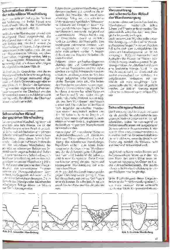 Vorschauseite 2: Ulcus cruris venosum - eine Hersausforderung