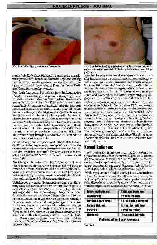 Vorschauseite 2: Frühund Spätkomplikationen bei Colostomie und Ileostomie aus chirurgischer Sicht