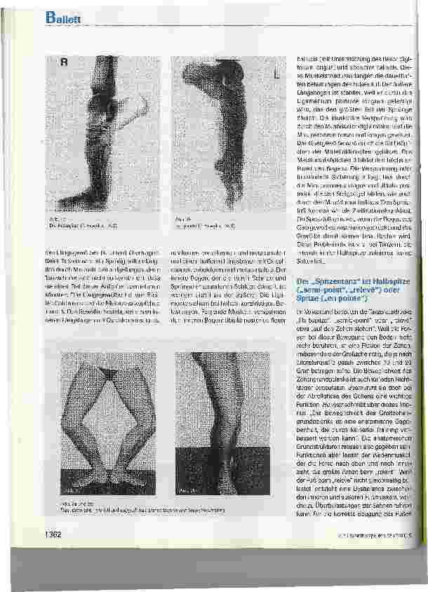 Vorschauseite 4: Das en dehors aus physiotherapeutischer Sicht - Eine Untersuchung von Tänzerinnen und Tänzern des Stadttheaters Luzern (Teill)