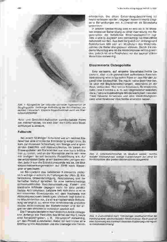 Vorschauseite 2: Lokale Knochenprozesse am infantilen Skelettsystem