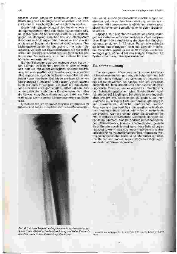 Vorschauseite 4: Lokale Knochenprozesse am infantilen Skelettsystem
