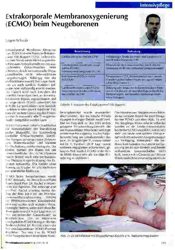 Vorschauseite 1: Extrakorporale Membranoxygenierung (ECMO) beim Neugeborenen