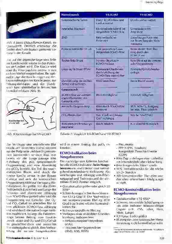 Vorschauseite 5: Extrakorporale Membranoxygenierung (ECMO) beim Neugeborenen