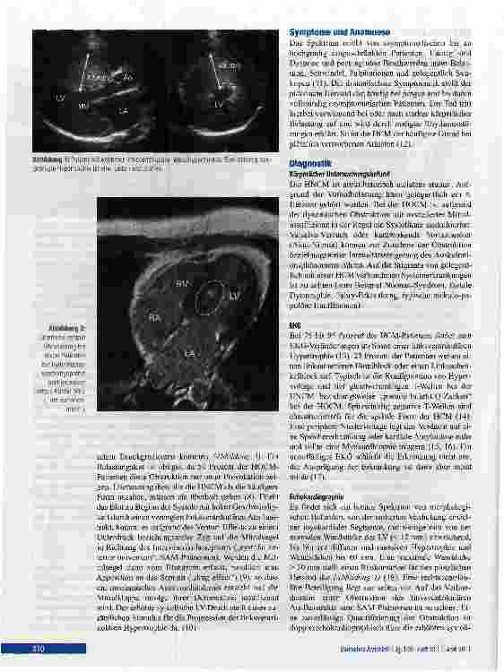 Vorschauseite 2: Diagnostik und Therapie bei hypertropher Kardiomyopathie